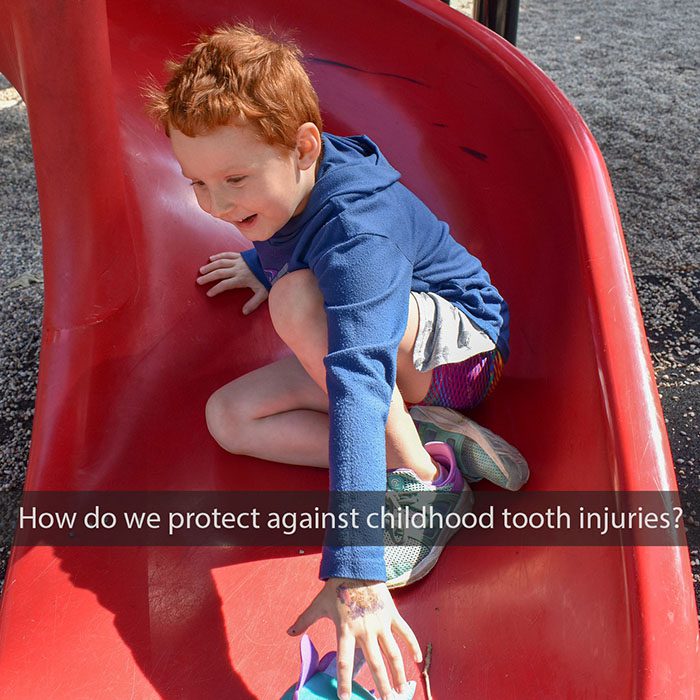 childhood-tooth-injuries-2022_700.jpg